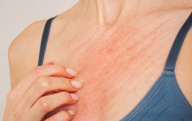 Šuga se pojavila u Dubrovniku