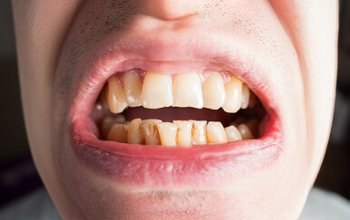 Želite doživjeti duboku starost? Tajna se skriva u vašim ustima