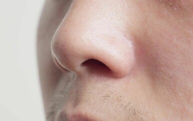 Stručnjaci pronašli vezu između kopanja nosa i neizlječive bolesti! Odvratna navika stvara probleme