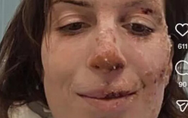 Talijanka koja je preživjela požar u švicarskom skijalištu: "Ne znam kako sam se spasila"