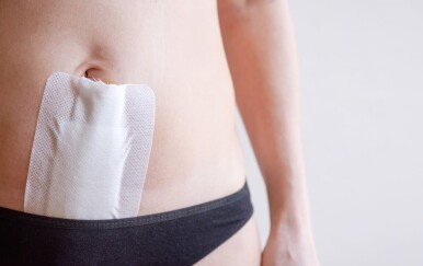 Histerektomija: Kada se radi, kako izgleda, koliko traje oporavak i kakve su posljedice?