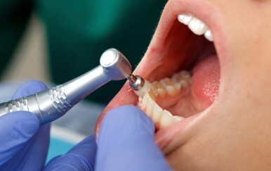 Crne plombe od 2026. postaju iznimka