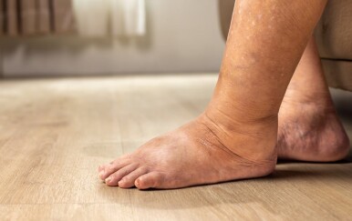 Više od 14 % ljudi ima ovu tihu bolest, a da to uopće ne zna – jeste li među njima?