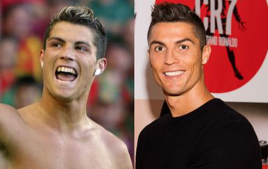 Cristiano Ronaldo prije i nakon što je sredio zube