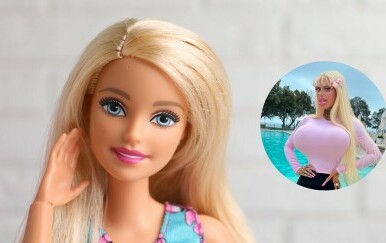 Plastičnim operacijama postala Barbie! Na operacije potrošila pravo bogatstvo