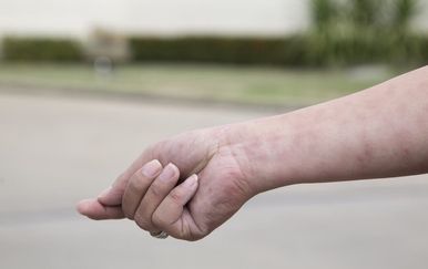 5 faktora koji mogu povećati rizik od leukemije – jedan mnogi i dalje podcjenjuju