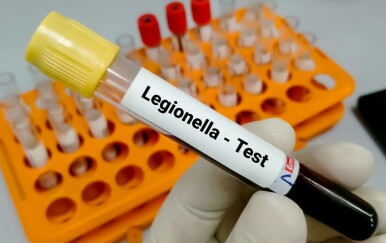 Legionarska bolest (legionela) na Rebru! Ovo su simptomi