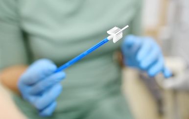 Velika promjena za žene: Rak vrata maternice sada možete otkriti bez odlaska ginekologu