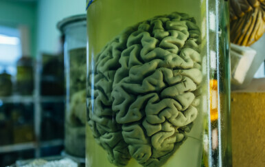 Mozak, ilustracija