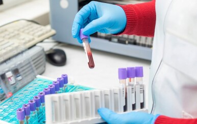 Marker za rak debelog crijeva: Ovaj krvni nalaz može otkriti puno više nego što mislite