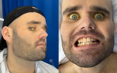 Pio je po šest boca vina dnevno, a sada dijeli stravičan utjecaj koji je imalo na njegovo zdravlje