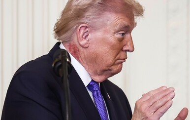 Crveni osip na vratu Donalda Trumpa izazvao rasprave: Liječnici otkrivaju što bi moglo biti u pitanju
