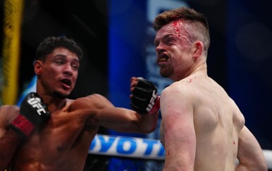 VIDEO Bivši FNC borac pokazao kako izgleda njegova dislocirana vilica nakon UFC borbe