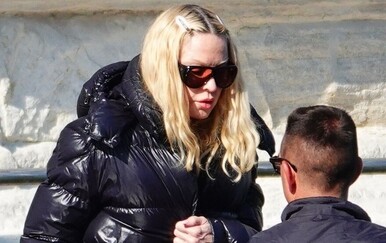 Madonna snimljena sa zavojima na licu u Italiji