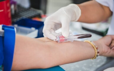 5 ključnih novosti koje morate znati o novim smjernicama za kolesterol