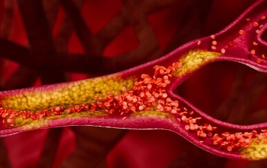 10 rizičnih pogrešaka vezanih uz kolesterol koje trebate izbjegavati ako imate više od 50 godina