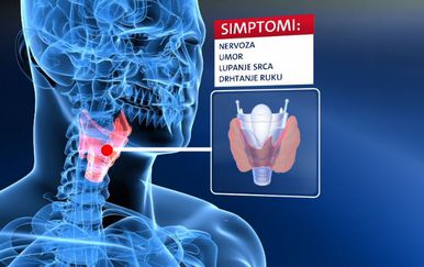 Simptomi bolesti štitnjače (Foto: Dnevnik.hr)