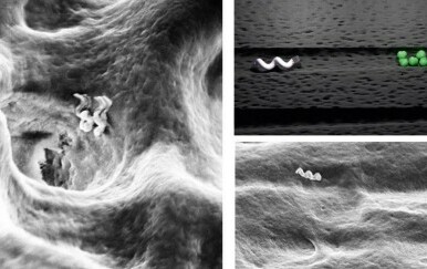 Nanoroboti u zubnim kanalima čiste bakterije