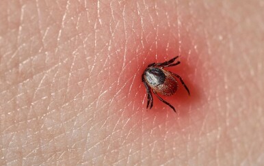 Kako izvaditi krpelja i što ako ostane glava ili nogica?