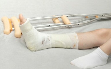 Noga u gipsu i štake pored osobe koja leži na krevetu