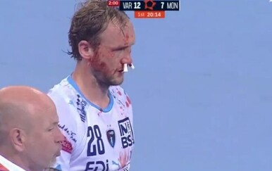 Užasan prekršaj na rukometu! Srbin teško nokautirao francusku zvijezdu