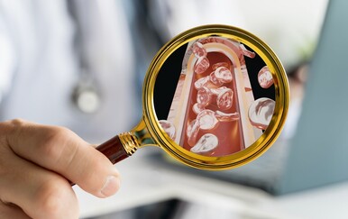 Mnogi misle da su zdrave, a liječnik tvrdi da stvaraju opasan plak u arterijama