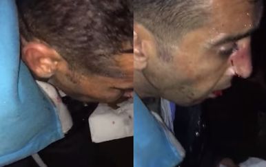 Ozlijeđeni migrant (Foto: screenshot/YouTube/Guardian News)