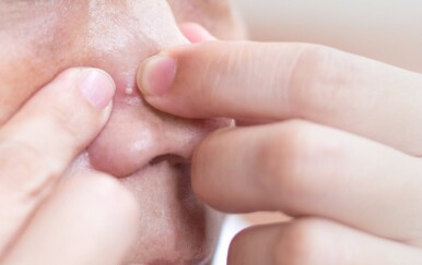 Ovo područje na licu nikada ne smijete dirati – evo zašto ga zovu “trokut smrti”!