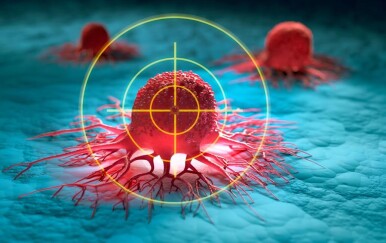 Najgori karcinomi: 5 najpodmuklijih vrsta raka koje gotovo nitko ne prepozna dok nije prekasno