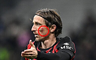 Luka Modrić i Petar Sučić imali su crvene mrlje na licu: Znate li zbog čega?