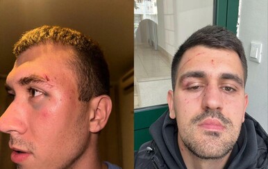 Užas u Dalmaciji: Nogometaši pretučeni nakon utakmice, tukao ih i predsjednik protivničkog kluba?