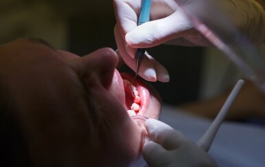Ovaj dentalni zahvat dramatično poboljšava vaše zdravlje – a većina ljudi to ne zna!