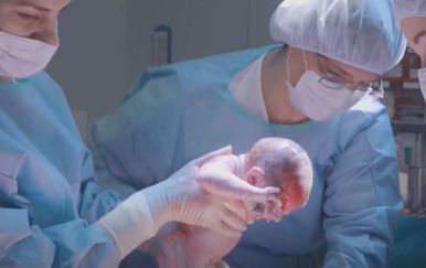 Žele porod uz epiduralnu - 4