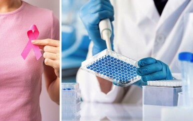 BRCA testiranje: Može otkriti rak dojke u ranoj fazi koja se lakše liječi! Evo o kakvom je testiranju riječ, gdje se provodi i koja je cijena