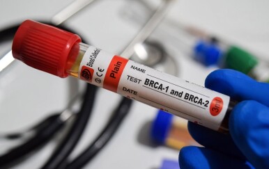 BRCA testiranje može vam spasiti život! Evo o čemu je riječ i koja je cijena