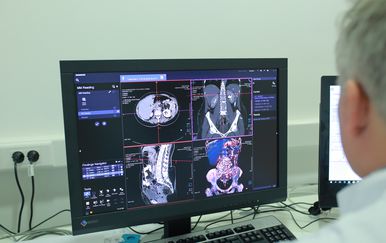 Radiochirurgia Zagreb predstavila novo postignuće (Foto: MKPS)