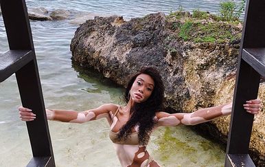 Winnie Harlow (Foto: Instagram)