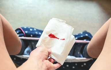 Uzroci krvi u stolici: Nije samo rak debelog crijeva!