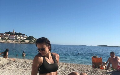FOTO Zlatna Hrvatica objavila kako joj izgledaju noge, prizor će vas šokirati