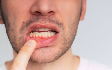 Želite zdravije desni? Ova vrsta prehrane daje najbolje rezultate