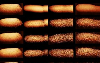 FOTO Pogledajte što točno antibiotici rade bakterijama