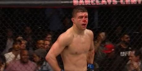 Al Iaquinta nakon poraza od Khabiba