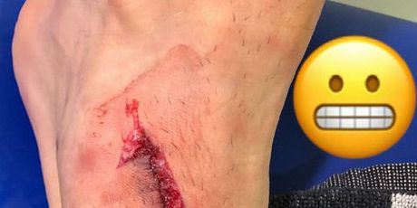 Mandžina noga nakon brutalnog starta vecina (Screenshot Twitter)