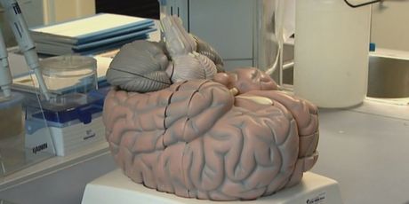 Mozak (Foto: Dnevnik.hr)