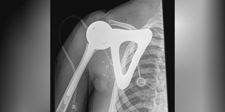 3D printano rame za dječaka - 1