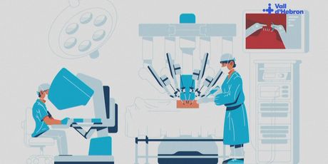 Transplantacija pluća u Španjolskoj, ilustracija - 1