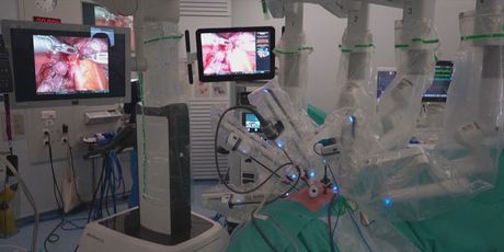 Transplantacija pluća u Španjolskoj, ilustracija - 2