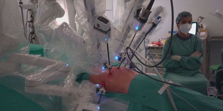 Transplantacija pluća u Španjolskoj, ilustracija - 4