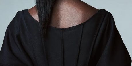 H&M haljina - 1