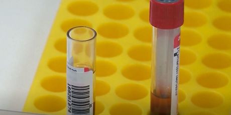 Sumnjivo rusko cjepivo protiv koronavirusa - 3